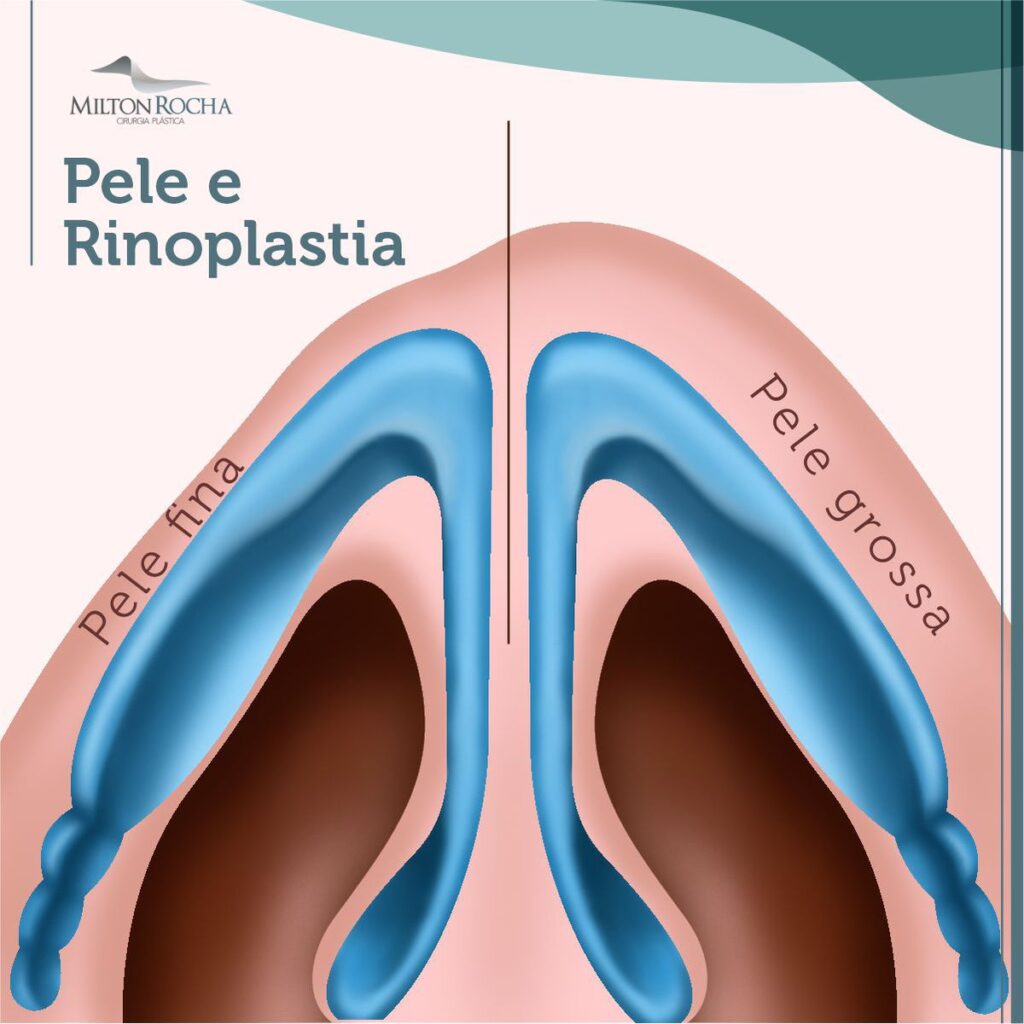 Cirurgia Plástica Recife Pele e Rinoplastia Cirurgia Plástica