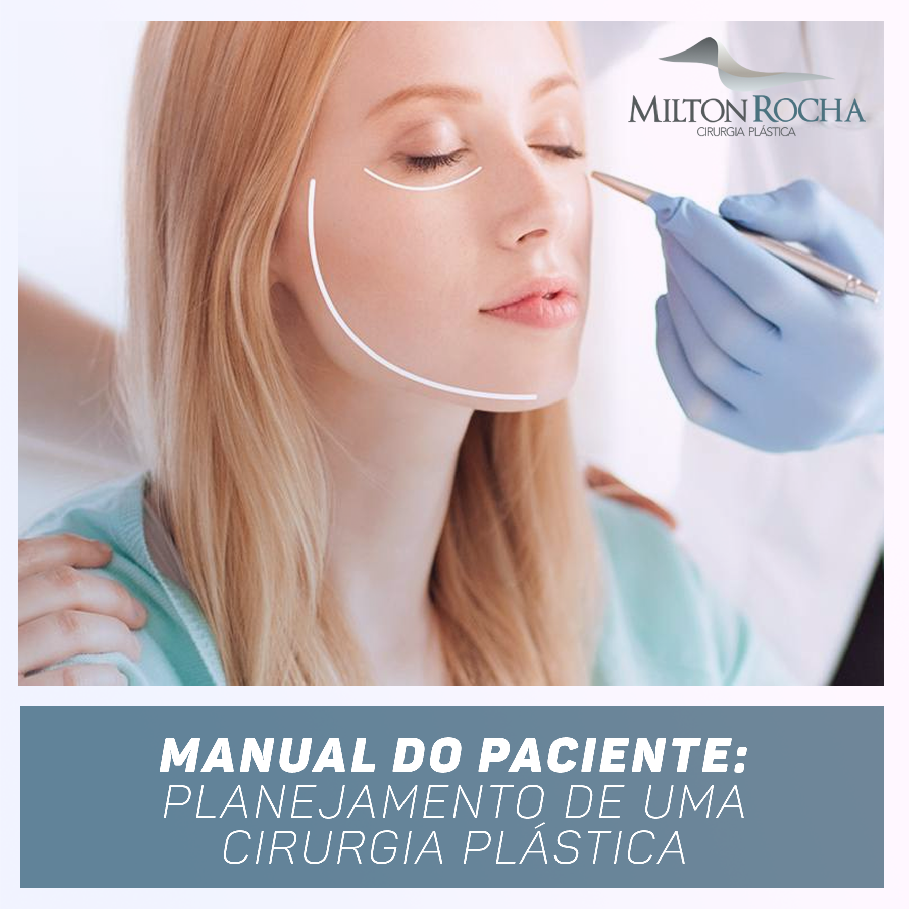 Read more about the article Manual do Paciente do Dr Milton Rocha: planejamento de uma cirurgia plástica