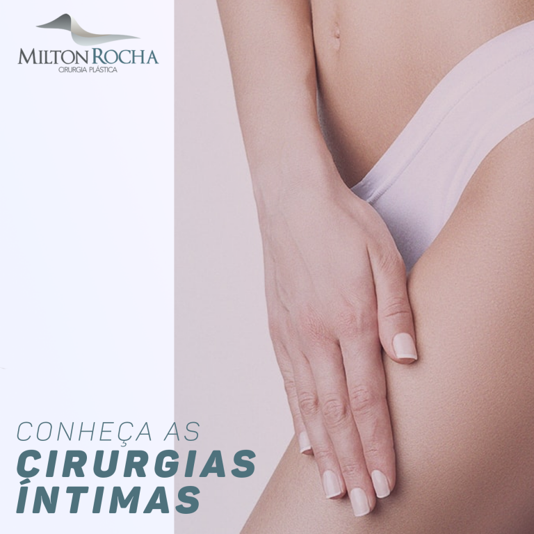 Read more about the article Conheça as cirurgias íntimas com o Dr Milton Rocha