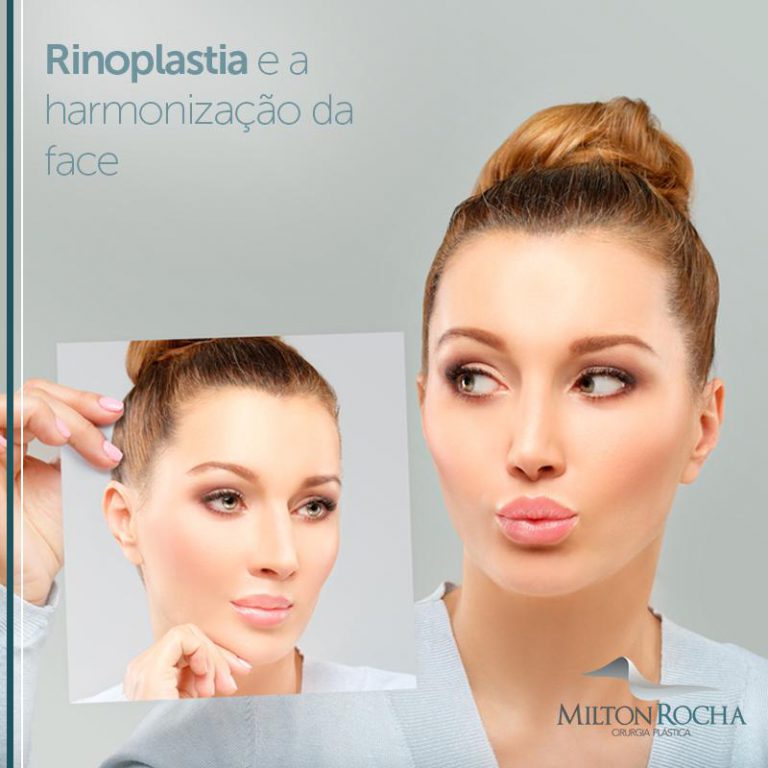 Read more about the article Rinoplastia e a harmonização da face