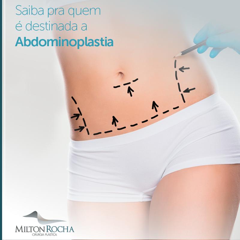 You are currently viewing Saiba para quem é destinada abdominoplastia