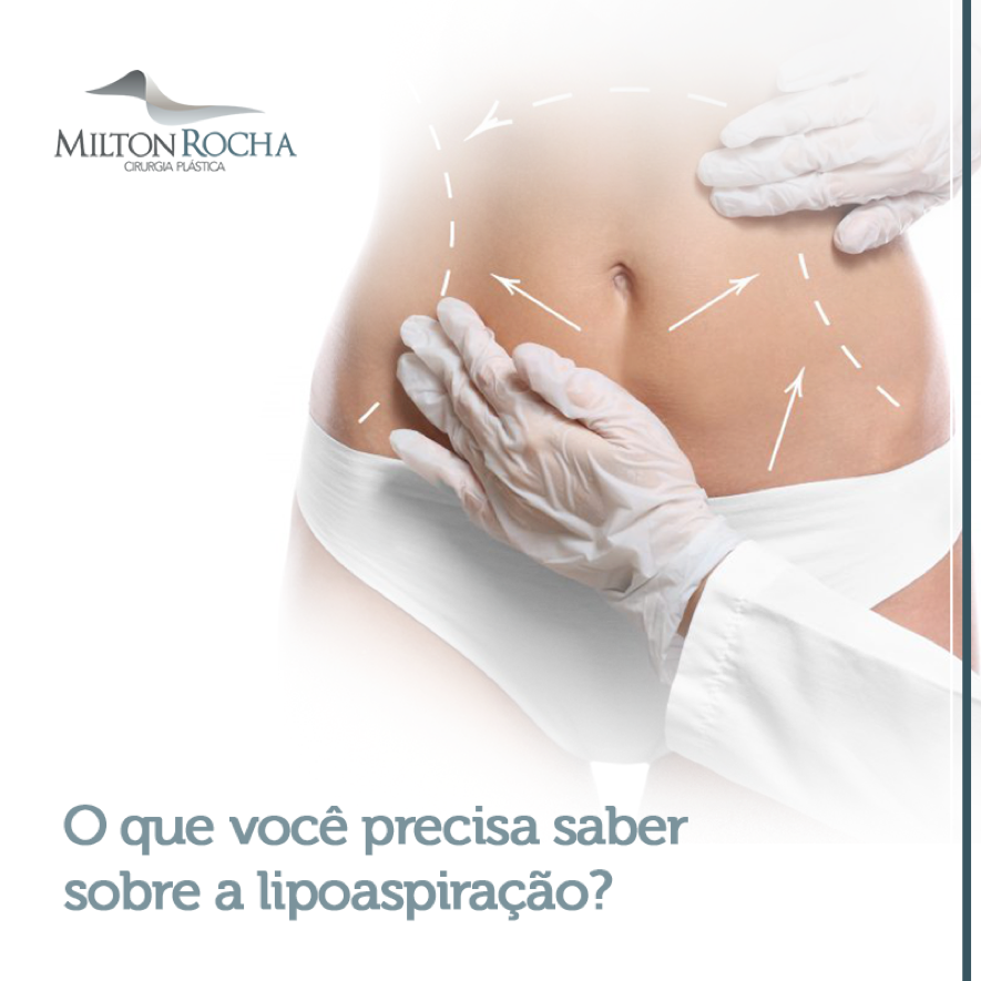 You are currently viewing O que você precisa saber sobre a lipoaspiração?