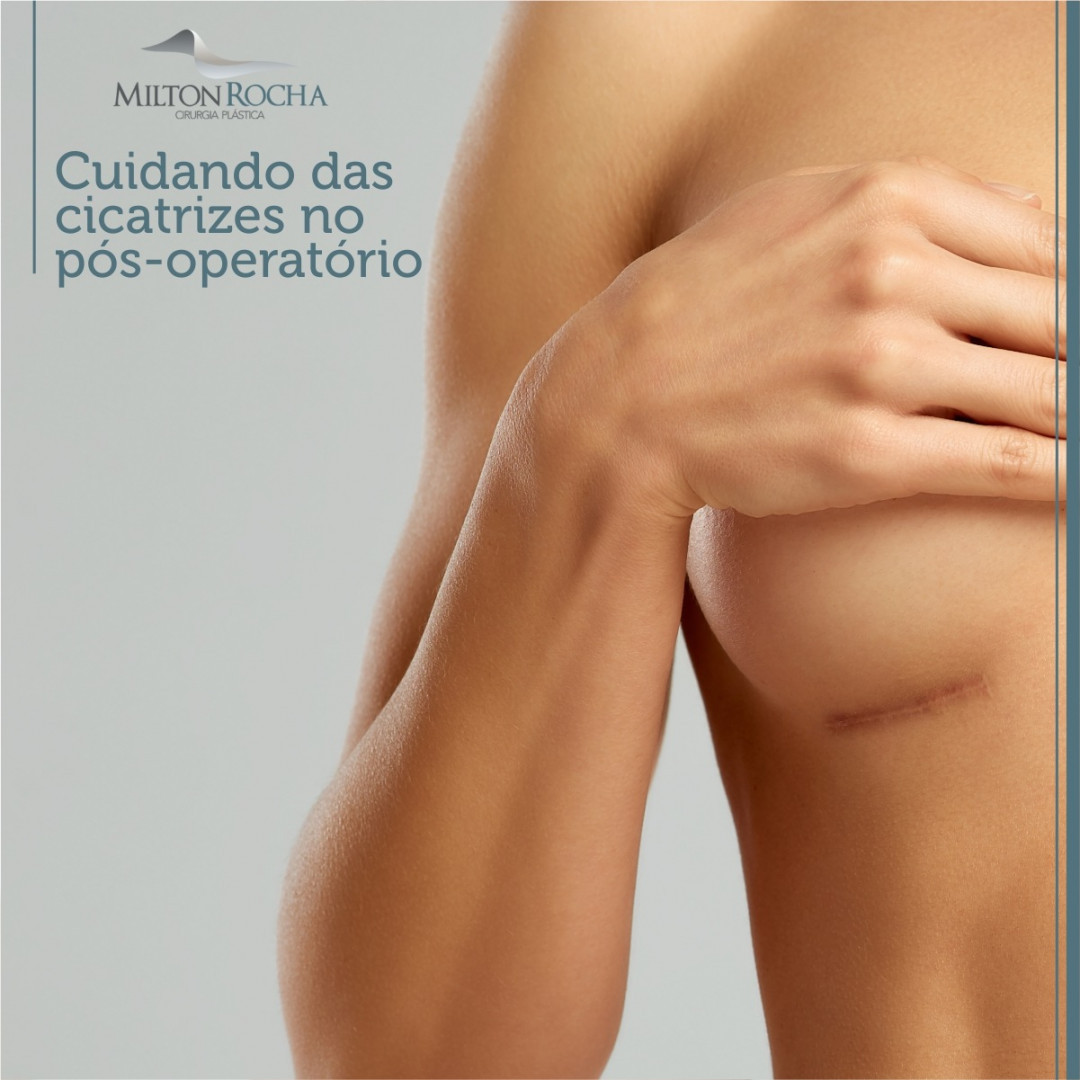 Read more about the article Cuidando das cicatrizes no pós-operatório