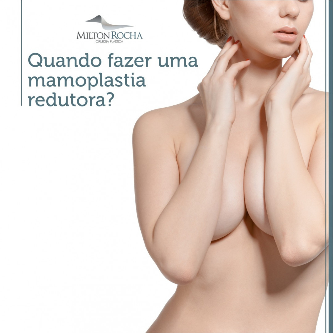 Read more about the article Quando fazer uma mamoplastia redutora?