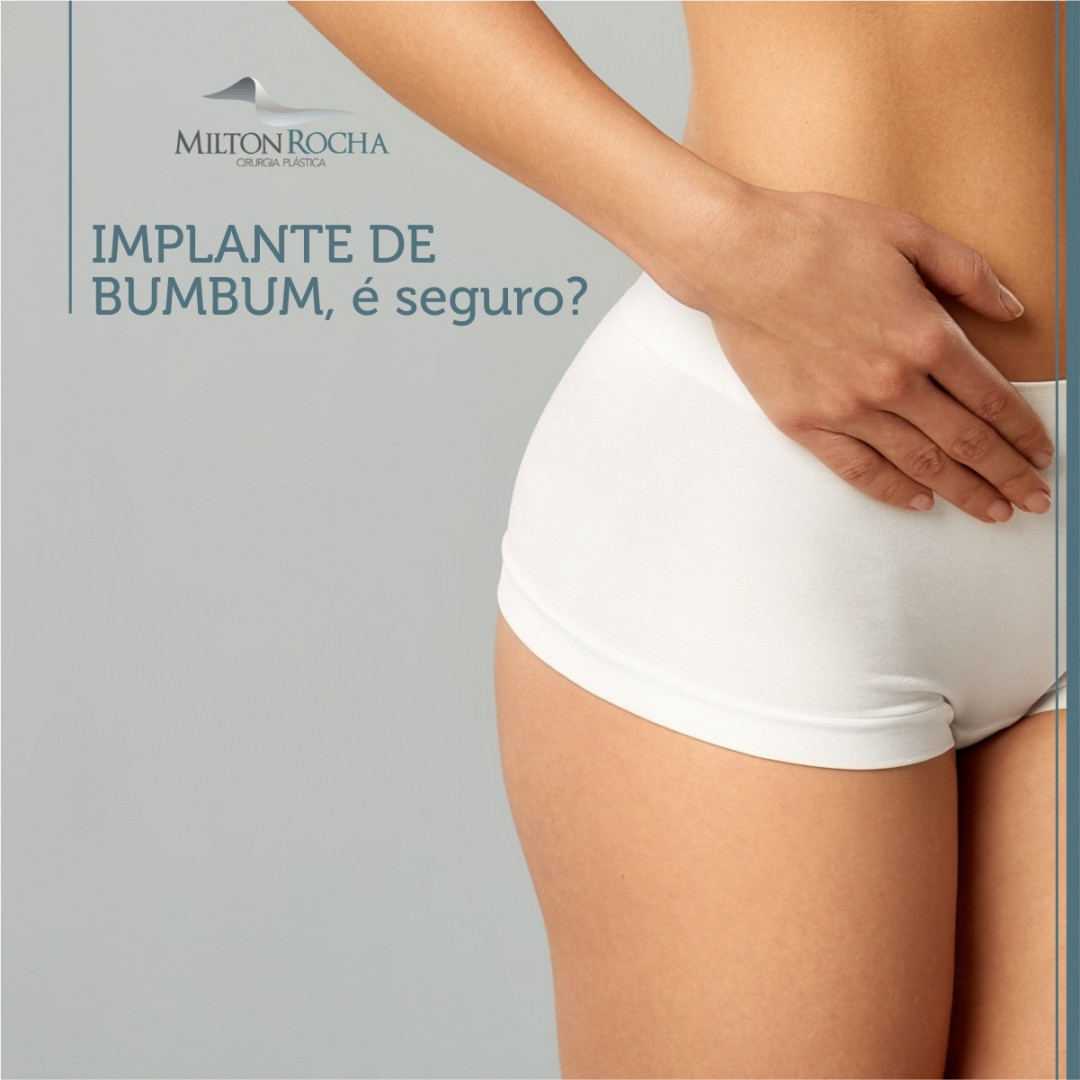 Read more about the article Implante de bumbum, é seguro?