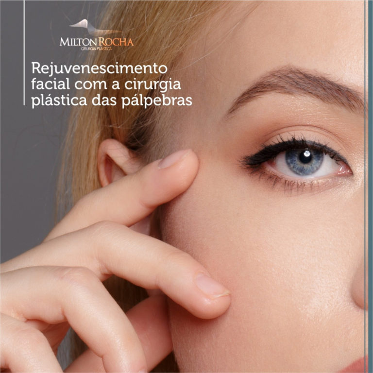 Read more about the article Rejuvenescimento facial com a cirurgia plástica das pálpebras