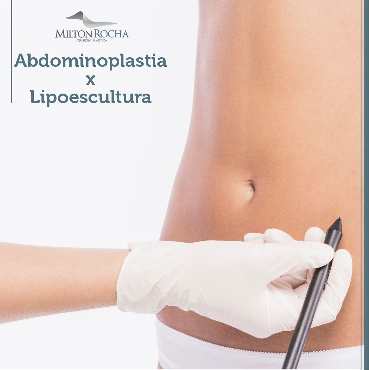 You are currently viewing ABDOMINOPLASTIA X LIPOESCULTURA