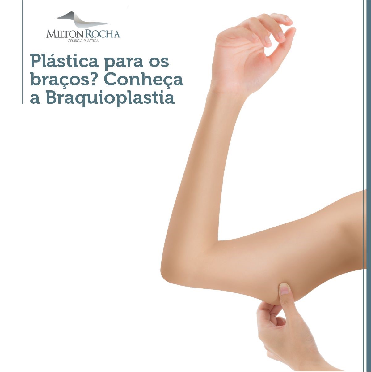 Read more about the article Plástica para os braços? Conheça a Braquioplastia
