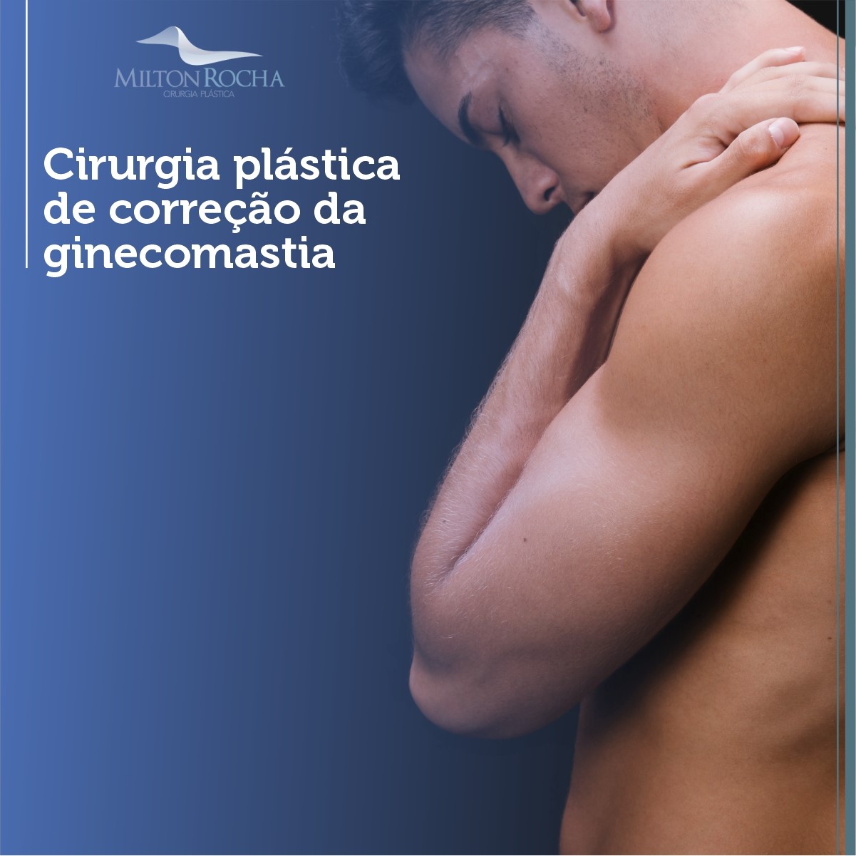 Read more about the article Cirurgia Plástica Recife – Ginecomastia – Cirurgia Plástica de correção da ginecomastia.