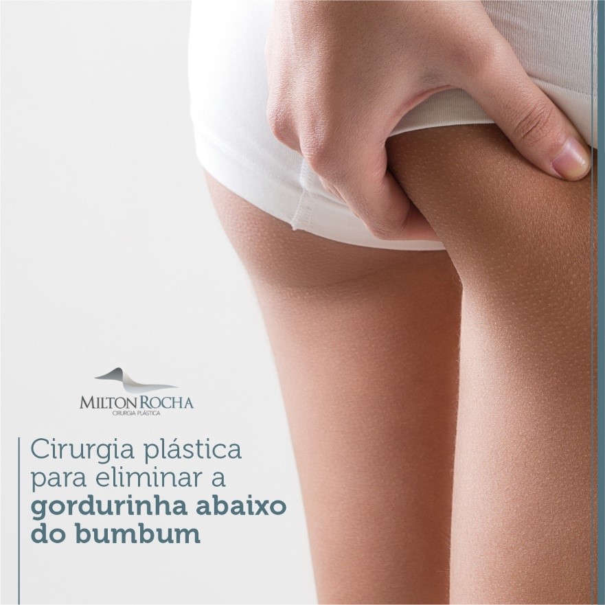 Read more about the article Cirurgia Plástica Recife – Cirurgia plástica para eliminar a gordurinha abaixo do bumbum