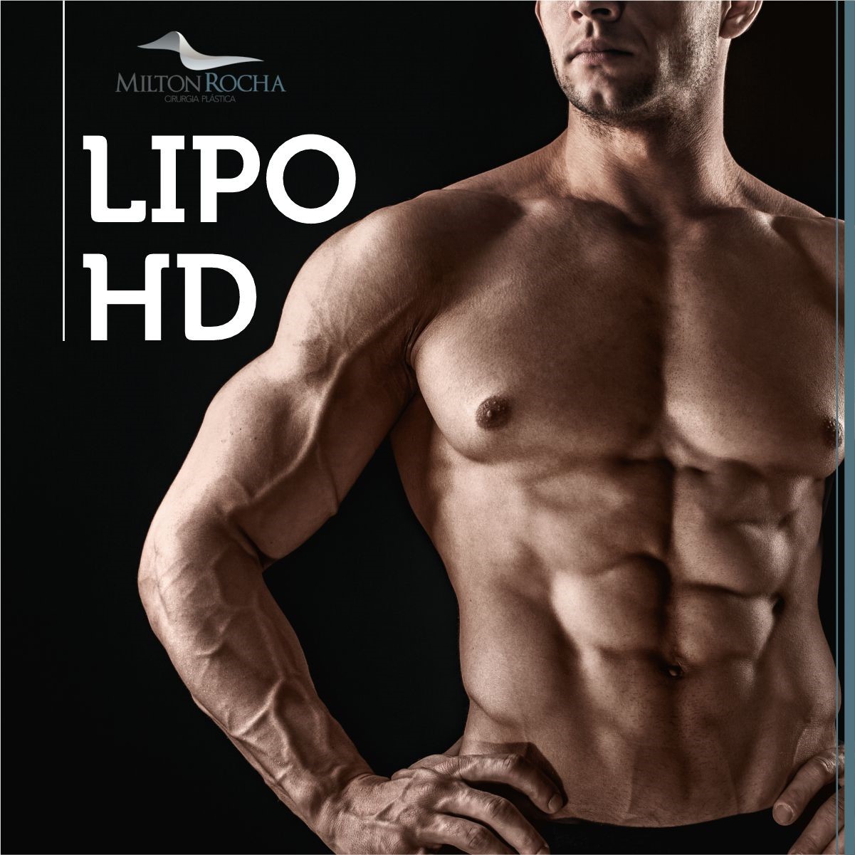 You are currently viewing Cirurgia Plástica Recife – Lipo HD