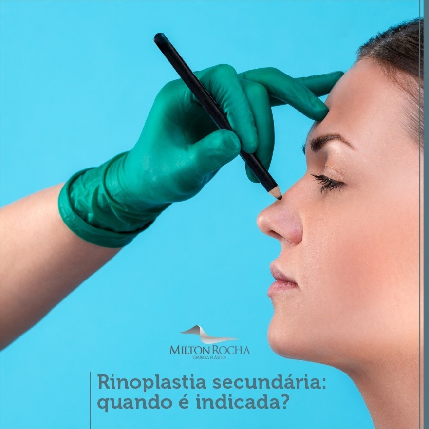 You are currently viewing Cirurgia Plástica Recife – Rinoplastia secundária: quando é indicada?