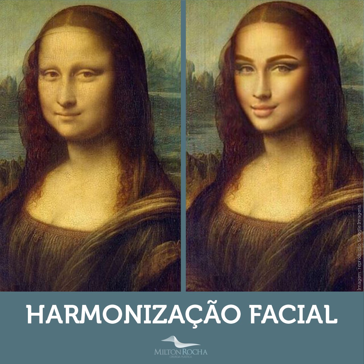 You are currently viewing Cirurgia Plástica Recife – Harmonização Facial