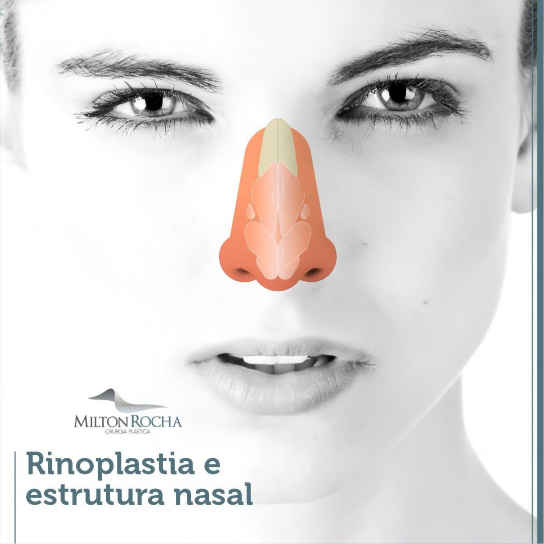 Read more about the article Cirurgia Plástica Recife | Rinoplastia e estrutura nasal