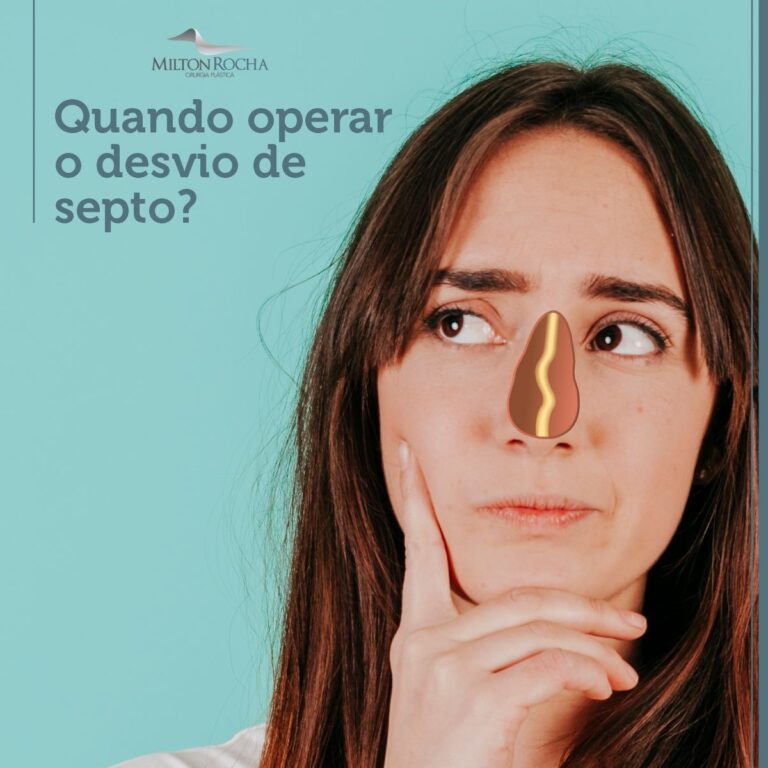 Read more about the article Cirurgia Plástica Recife | Quando operar o desvio de septo?