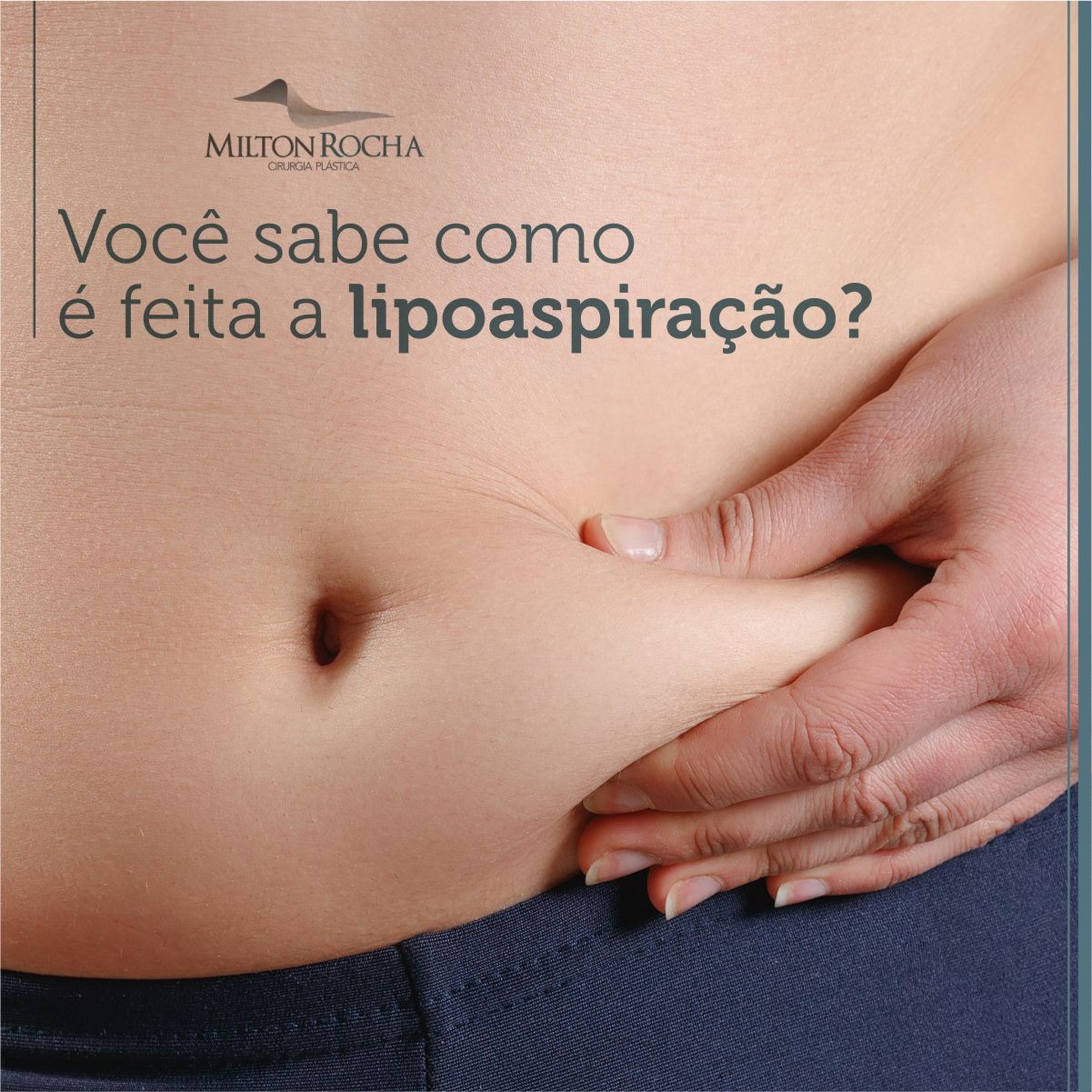 Read more about the article Cirurgia Plástica Recife – Você sabe como é feita a lipoaspiração?
