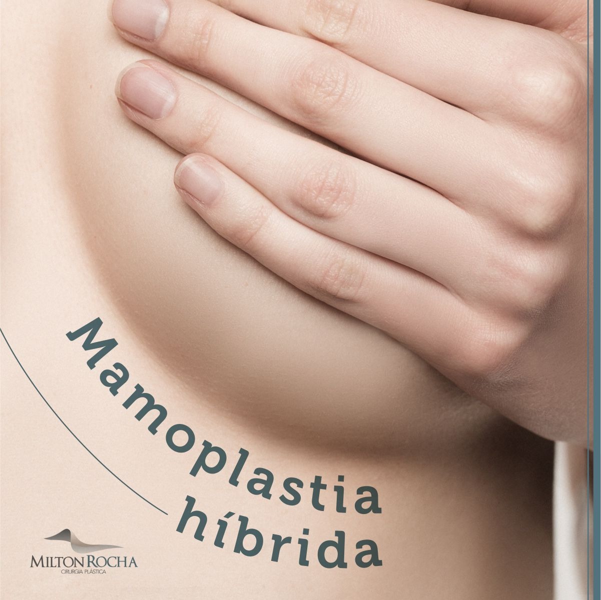 You are currently viewing Cirurgia Plástica Recife – Mamoplastia híbrida