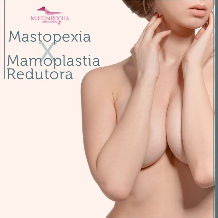 Read more about the article Cirurgia Plástica Recife – Mastopexia x Mamoplastia Redutora