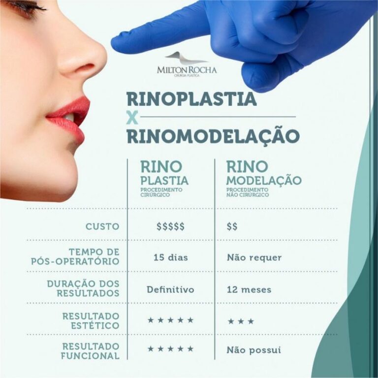 Read more about the article Cirurgia Plástica Recife – Rinoplastia x Rinomodelação.