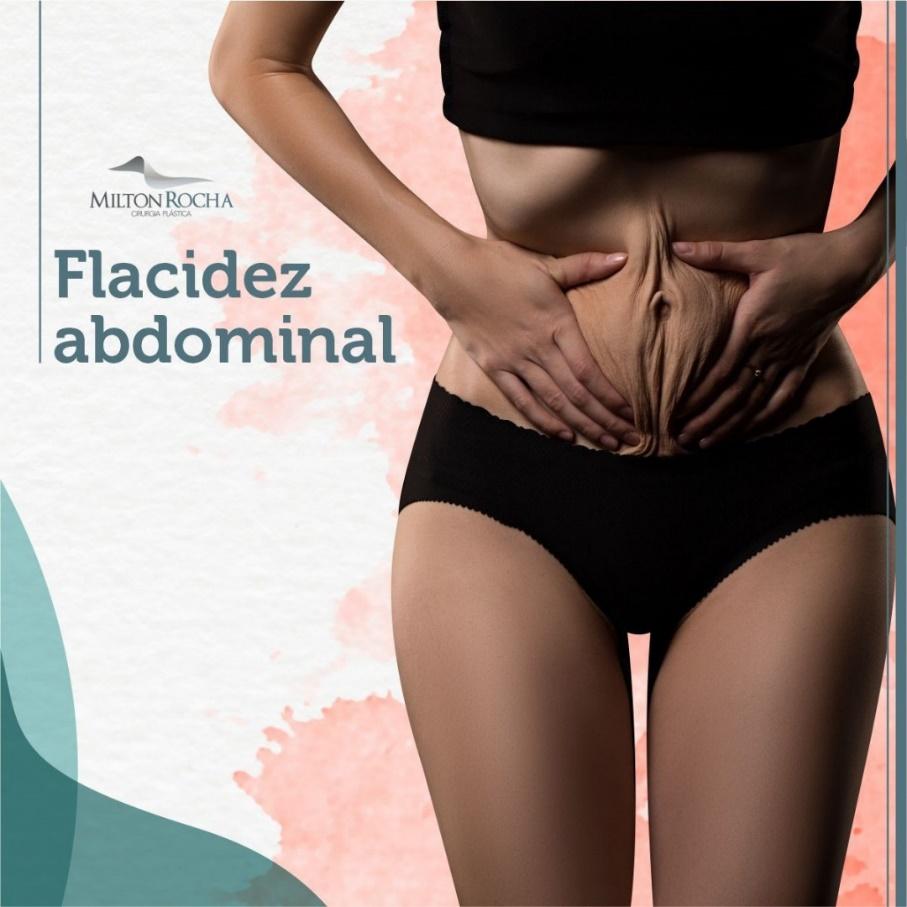 You are currently viewing Cirurgia Plástica Recife – Flacidez abdominal