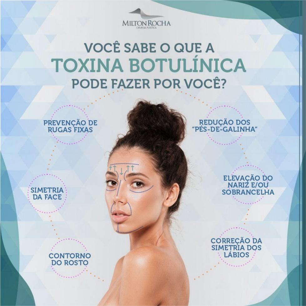 Read more about the article Cirurgia Plástica Recife – Você sabe o que a toxina butolinica pode fazer por você?