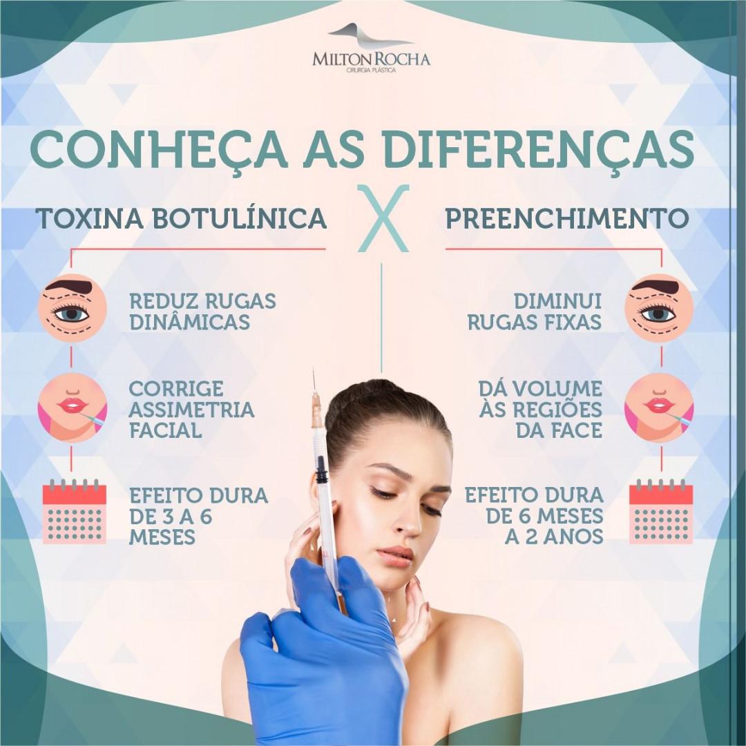 You are currently viewing Cirurgia Plástica Recife – conheça as diferenças: Toxina Butolinica x Preenchimento