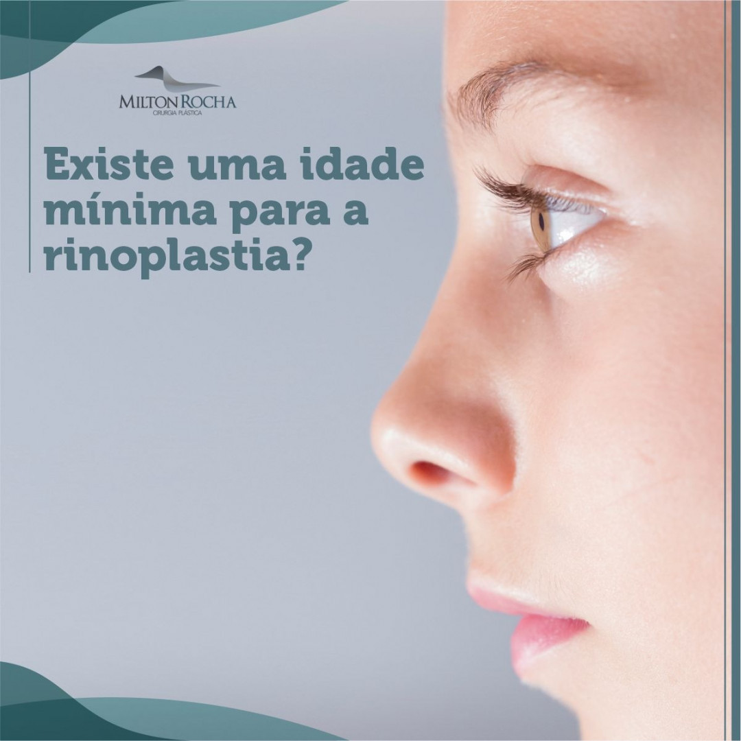 Read more about the article Cirurgia Plástica Recife – Existe uma idade mínima para a rinoplastia?