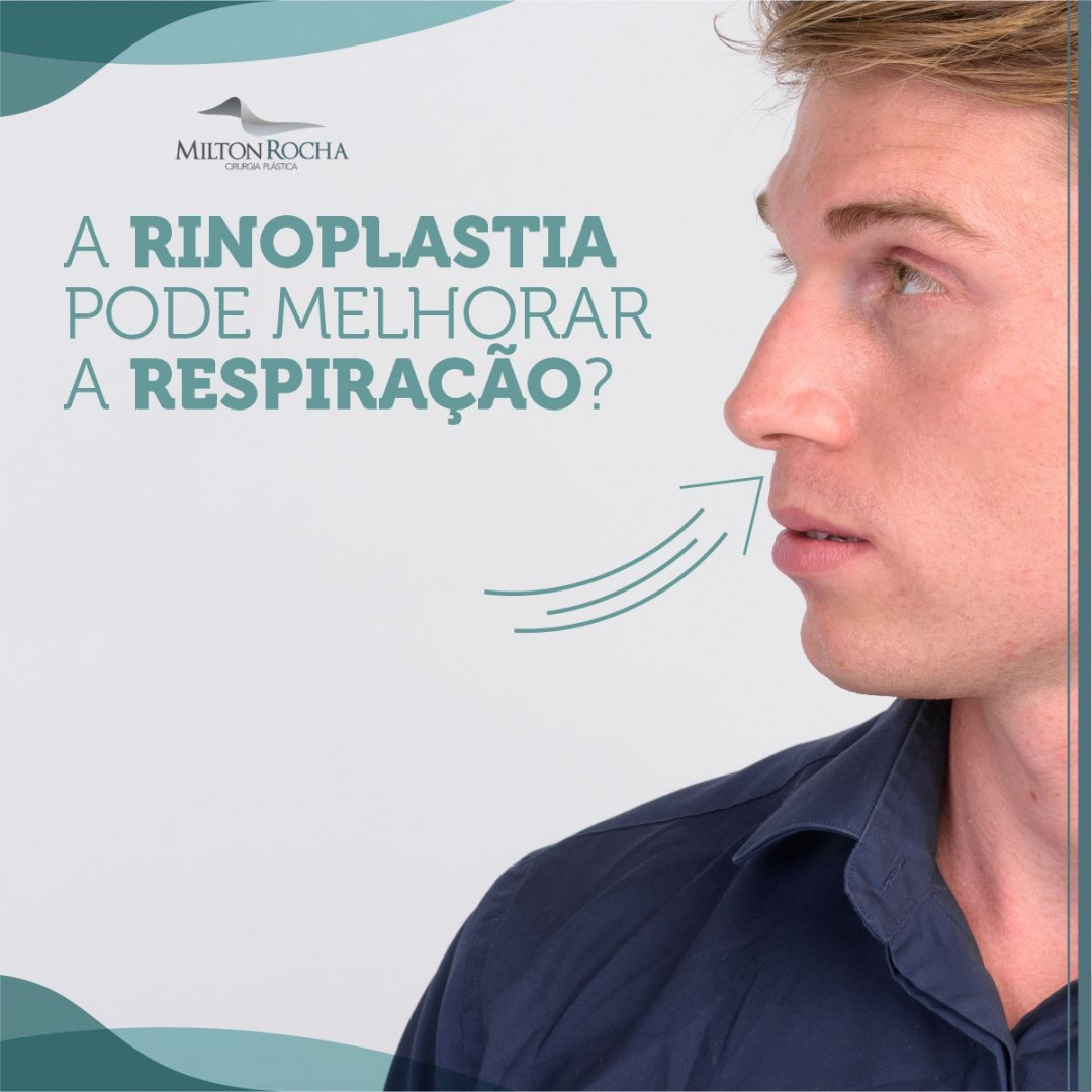 Read more about the article Cirurgia Plástica Recife – A rinoplastia pode melhorar a respiração?