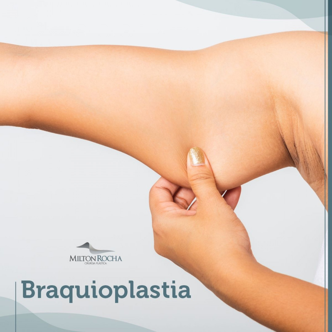 Read more about the article Cirurgia Plástica Recife – Braquioplastica
