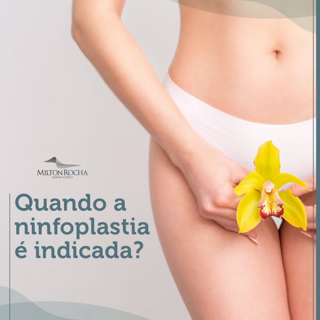 You are currently viewing Cirurgia Plástica Recife – Quando a ninfoplastia é indicada?